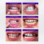 Load image into Gallery viewer, ✨ VEELANOO™ Smile Patches – Instant Teeth Whitening
